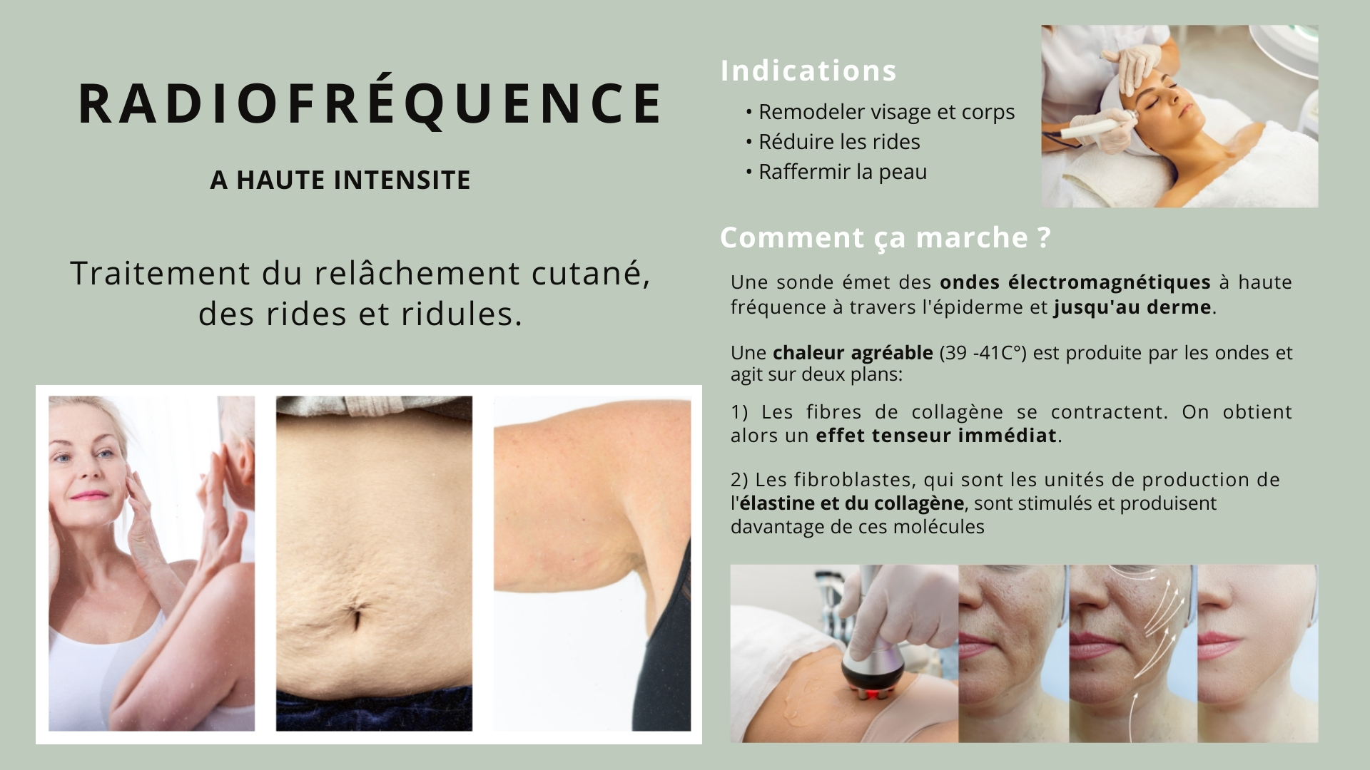 radiofréquence